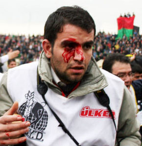 <b>Mehmet Kayahan</b> yaralandı - 211070_detay