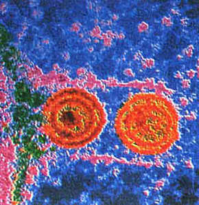 Herpes virüsüyle kanser tedavisi