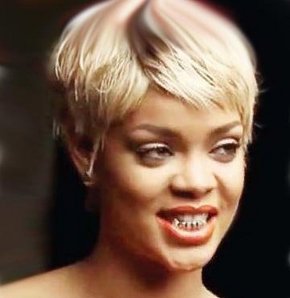 Rihanna’nın dişlerine ne oldu?