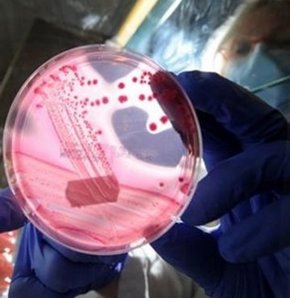 Vietnam kuş gribi H5N1 virüsü
