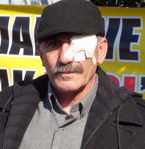 Trolcünün saldırısında gözünü kaybeden balıkçı taburcu oldu