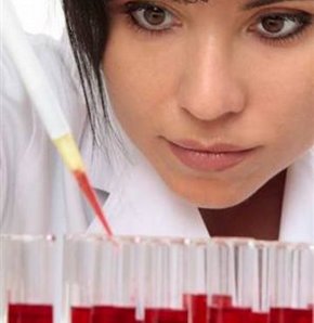 HIV testleri