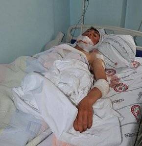 17 yaşındaki çobana ayı saldırdı, gümüşhane, ayı saldırısı