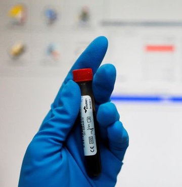 Diyarbakır’daki HIV skandalıyla gündeme gelen nikâh öncesi zorunlu testler, 88 yıllık yasaya göre yapılıyor. Yasada HIV ve Hepatit B-C testleri zorunlu değil