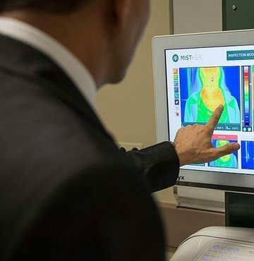 Deri kanserinin teşhisinde bilgisayar teknolojisinin dermatologlara göre daha başarılı olduğu tespit edildi