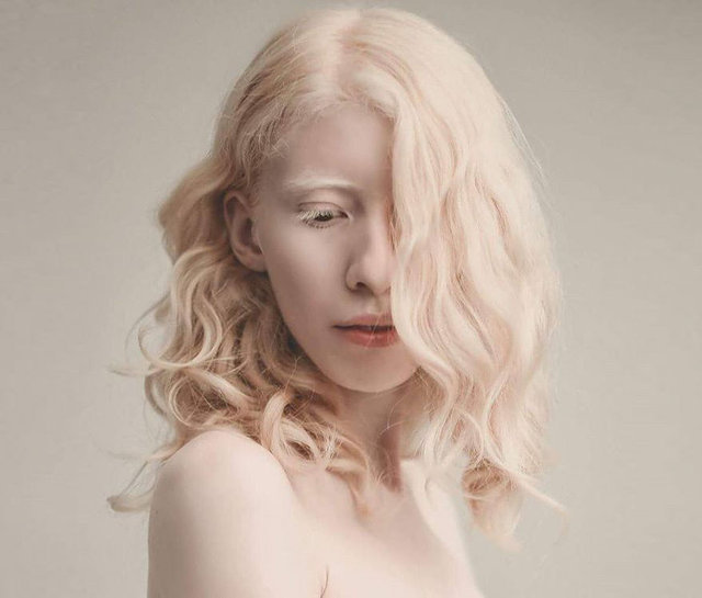 Albinoların eşsiz güzellikleri fotoğraflara yansıdı