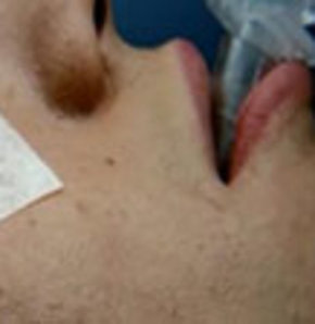 Bir Sehir Efsanesi Daha Yikildi Saglik Haberleri