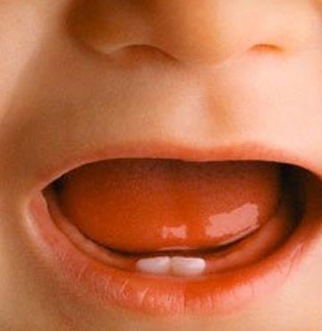 Bebeğinizin dişlerini böyle koruyun