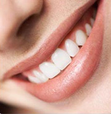 Dişleriniz on kat daha beyazlasın mı?