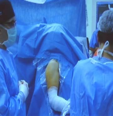 Türk doktorların ameliyatını dünya izledi VİDEO
