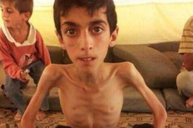 Madaya'da 16 kişi daha açlıktan öldü