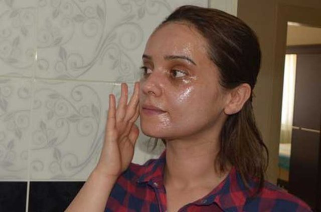 Bilecik'te güzelleşmek için güzellik salonuna giden genç kadının yüzü yandı!