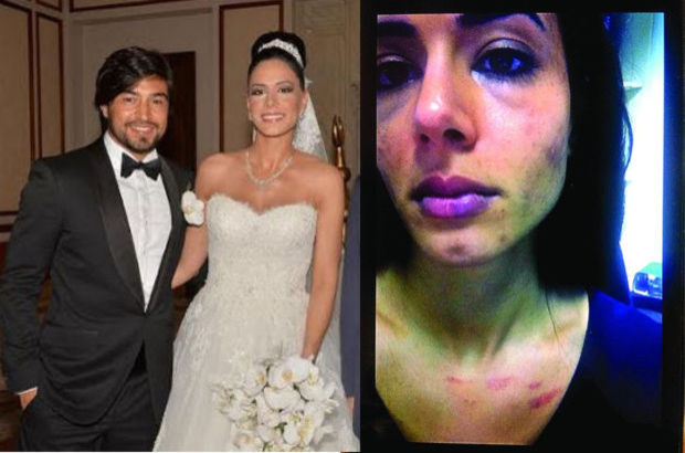 İbrahim Toraman'dan dayak iddialarına yanıt