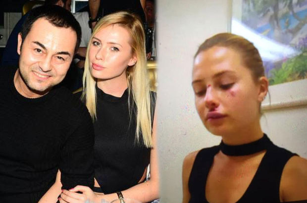 Serdar Ortaçın eşi Chloe Loughnan: Zor günler yaşadım Serdar Ortaçın eşi Chloe Loughnan: Zor günler yaşadım