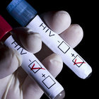 DÖRT ÜLKEDEN DAHA HIV VİRÜSÜNE DARBE