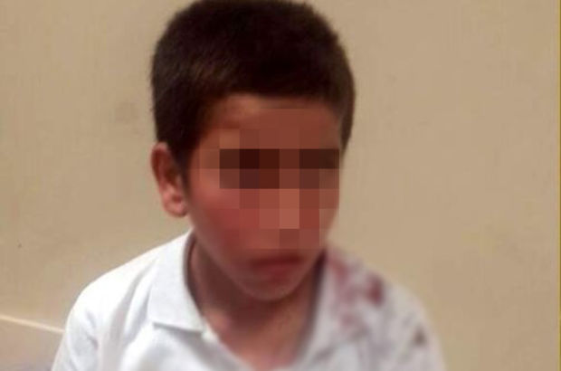 Adıyaman'da Suriyeli çocuğun tabureyle dövüldüğü iddiası
