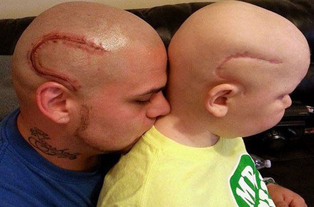 Beyin ameliyatı olan oğluna destek olmak için ameliyat izi şeklinde dövme yaptırdı!