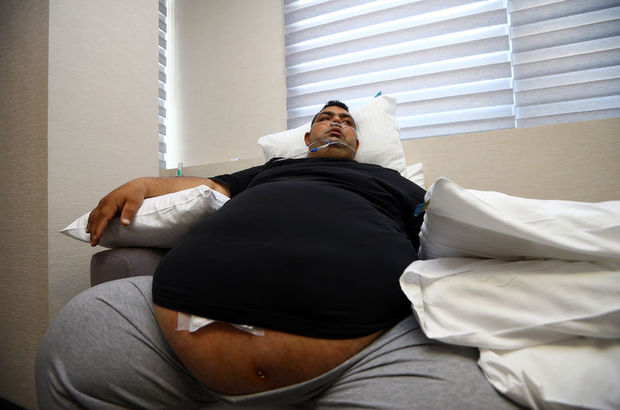 240 kilo olan Hakan Hassu için son umut robotik cerrahi!