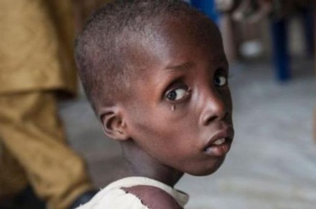BM: 4,5 milyon kişi acil gıda yardımı bekliyor