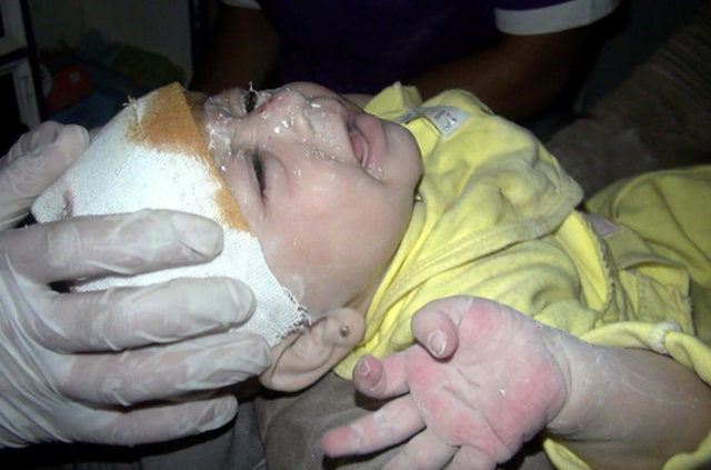 Halep'te 1 aylık bebek enkaz altından böyle kurtarıldı