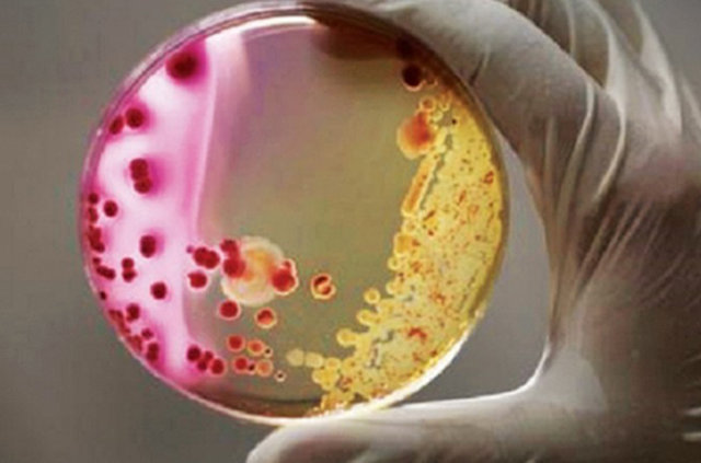 Vücudumuzdaki yeni organ Mikrobiyom