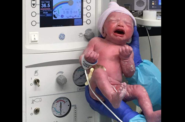 Bu bebek iki kez doğdu!