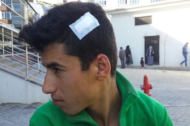 Suriyeli grup arasında çıkan kavgada bir çocuk yaralandı
