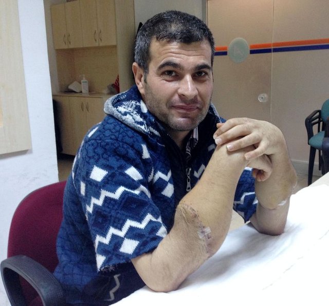 Çift kol nakilli Mustafa Sağır artık ellerini kullanıyor!