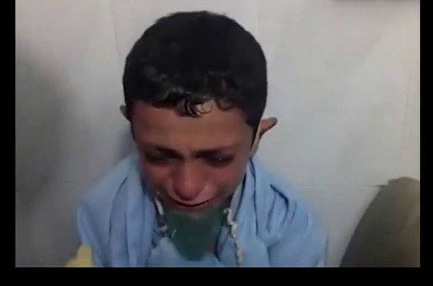Suriye'de klor gazına maruz kalan çocuk: Ölecek miyim bayan?