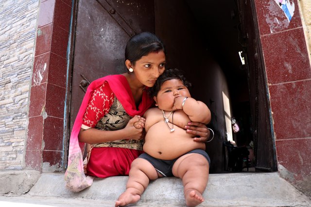 8 aylık Chahat Kumar bebek 17 kilo!