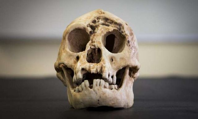 Hobbit (Homo Floresiensis) kafatası