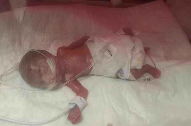Konya'da 560 gram doğan Erva bebek 4 ay sonra taburcu oldu