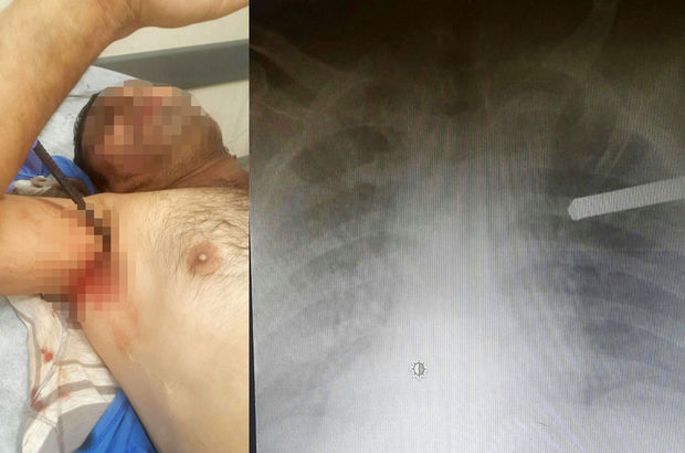 İzmir'de yaşayan talihsiz adamın göğsüne 1 metrelik demir saplandı!