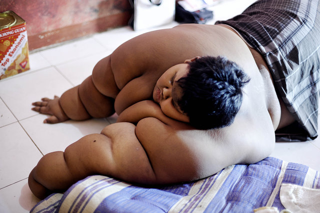 Endonezya'da yaşayan Arya Premana 31 kilo verdi!