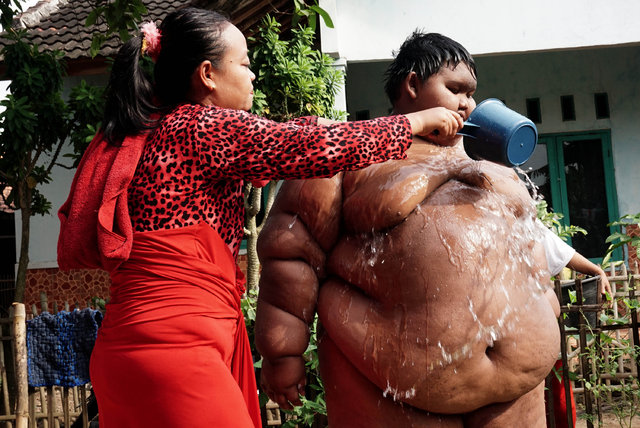 Endonezya'da yaşayan Arya Premana 31 kilo verdi!