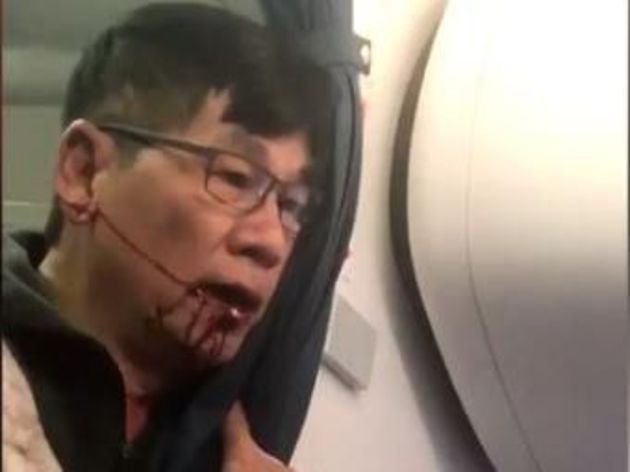 United Airlines şiddetine maruz kalan David Dao