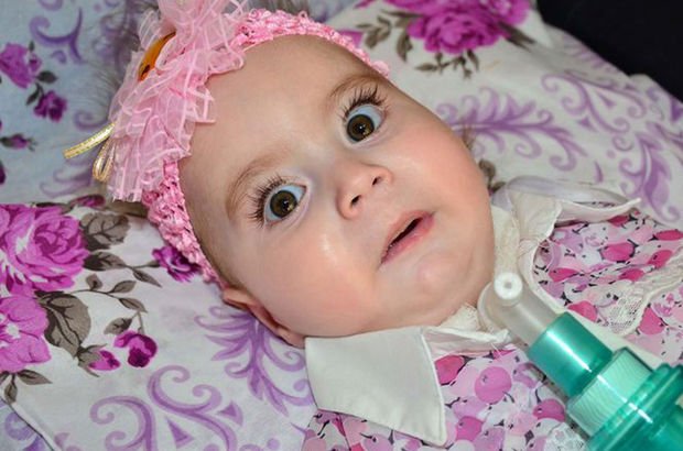 SMA hastası Zeynep bebek yaşamını yitirdi
