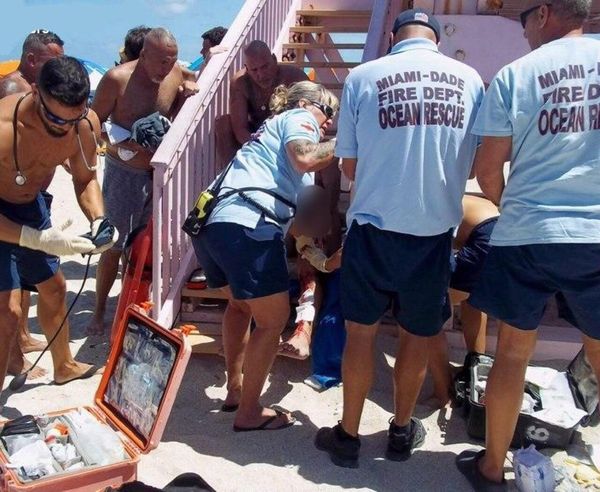 Miamide köpek balığı saldırısı - Dünya Haberleri