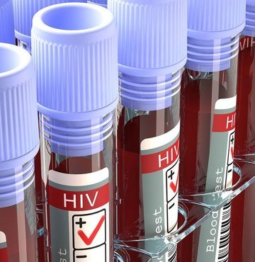 HIV virÃ¼sÃ¼nÃ¼n enjekte edildiÄi 4 ineÄin, 35-50 gÃ¼n iÃ§erisinde virÃ¼se karÅÄ± antikorlar Ã¼rettiÄi gÃ¶zlemlendi