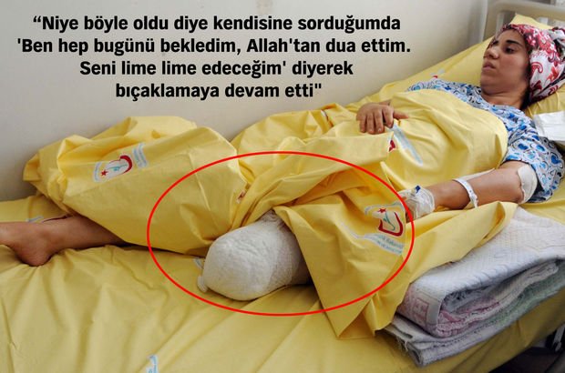 Gaziantep'te eşinin işkence ettiği ve sol bacağı dizden kesilen kadın yaşadıklarını anlattı
