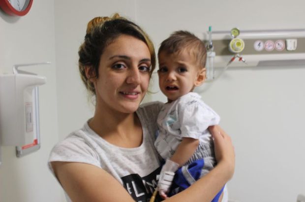 Yemek borusu gelişmeden doğan bebekler Yemek borusu gelişmeden doğan bebekler