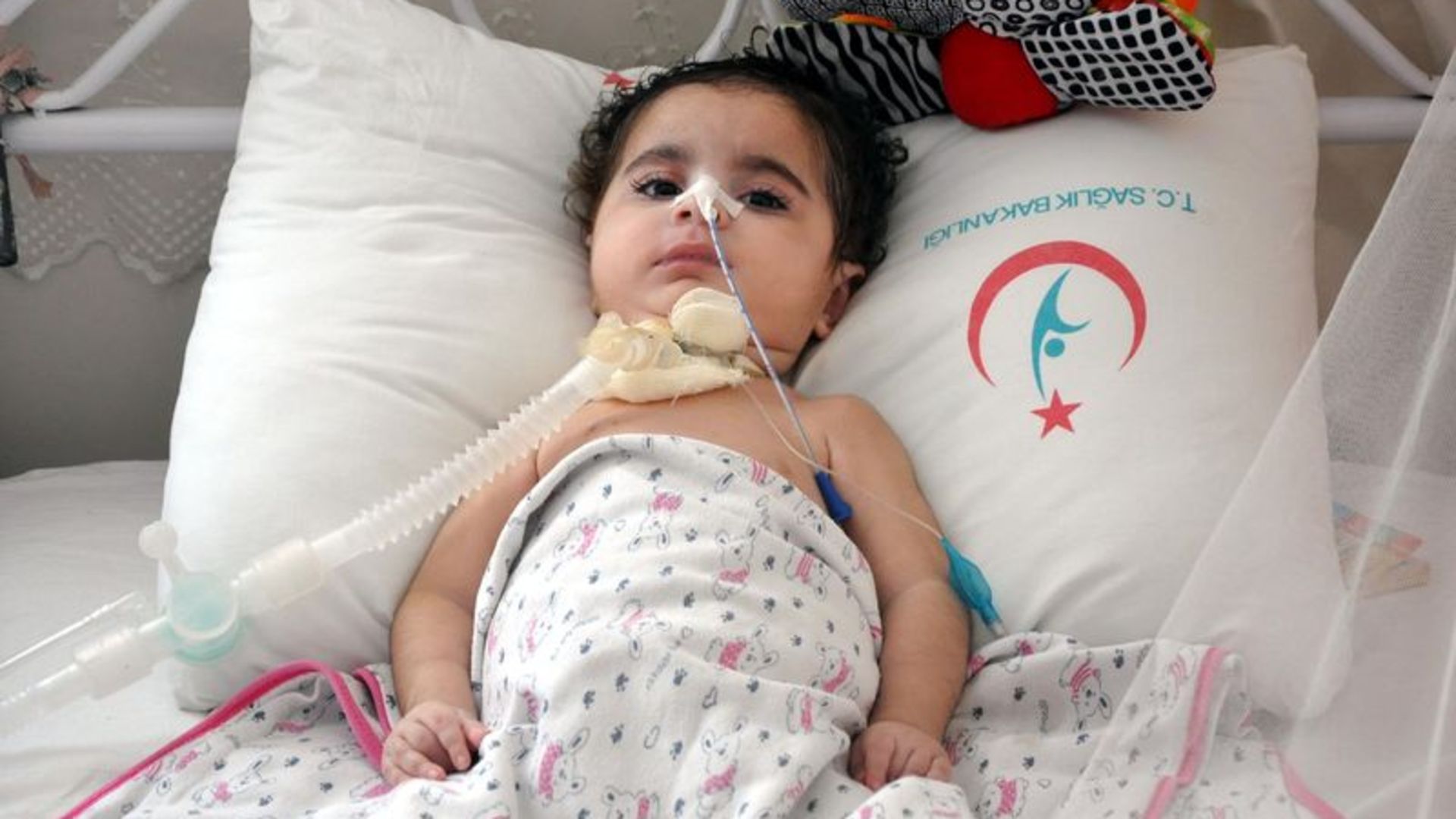 SMA hastalığı (Gevşek Bebek Sendromu) nedir, nasıl tedavi edilir SMA hastalığı (Gevşek Bebek Sendromu) nedir, nasıl tedavi edilir