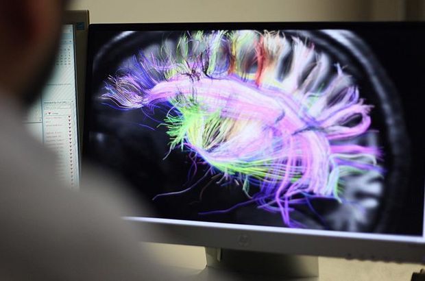 Beynin elektrik bağlantılarının haritası çıkarıldı