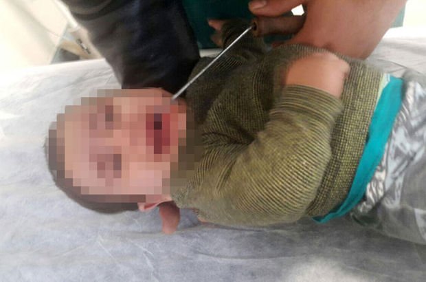 Antalya'da 9 aylık Muhammed'in ağzına kova demiri saplandı