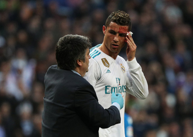 Real Madrid Deportivo'yu 7-1 mağlup etti! Ronaldo gol için yaralandı! Ronaldo, telefonla kendisine baktı!