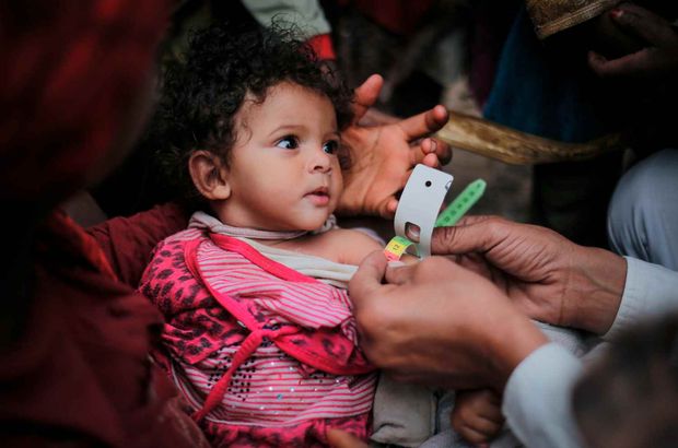 Yemen'de 22 milyon kişi acil yardım bekliyor!