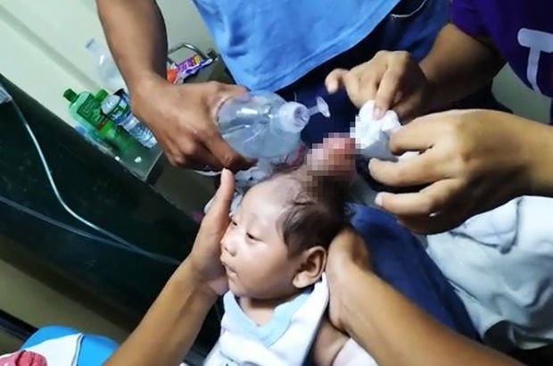 Filipinler'de boynuzlu bebek doğdu!