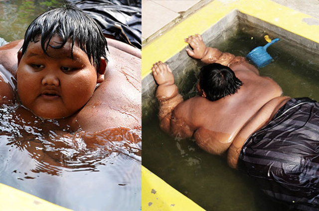 Dünyanın en şişman çocuğu olan Arya Premana 83 kilo verdi!