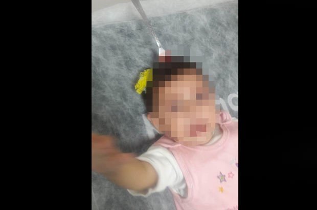 Haberler: Bebeğin kafasındakini gören doktorlar şoke oldu