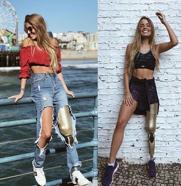 Brezilyalı model Paola Antonini geçirdiği bir trafik kazası sonucu bacağını kaybetti. Ancak pozitifliğiyle adeta hayata meydan okuyan genç model Paola Antonini, sosyal medyada paylaştığı fotoğraflarıyla hayranlarına ilham oluyor